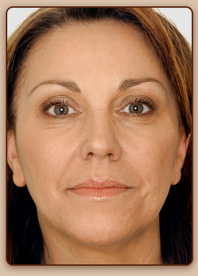 Adaptive ToneMatch Cream Stick - Hydrating Coverage + Built-In Blending Brush